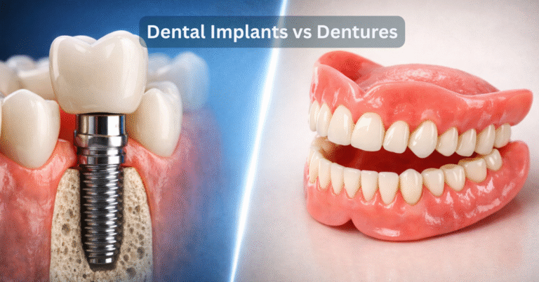  Dental Implants vs Dentures: Which Is Better for You?